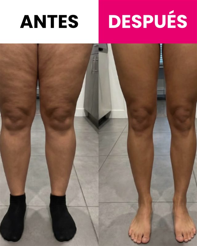 Antes y después de alumna