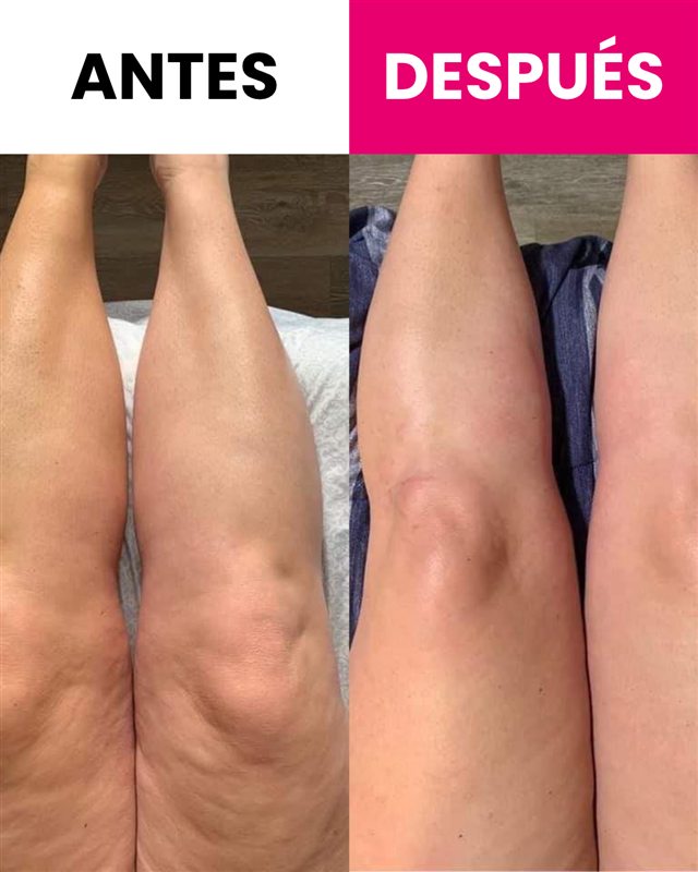 Antes y después de alumna