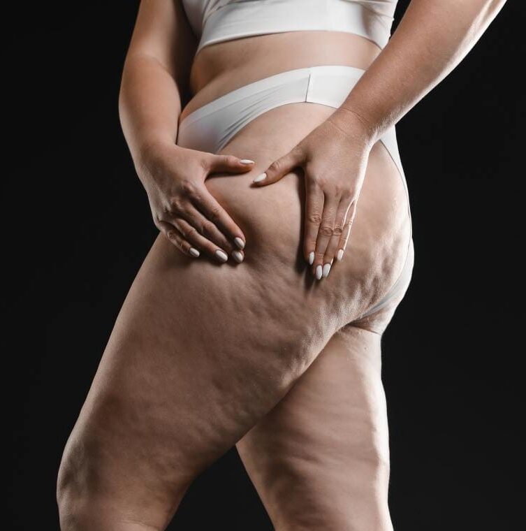 Piernas con retención e inflamación
